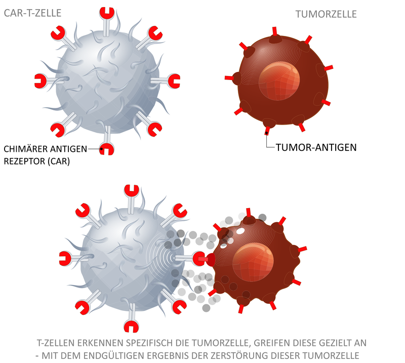 CAR-T-Zelle zerstört eine Tumorzelle: Dieser Prozess läuft ohne weitere Aktivierung der CAR T Zelle ab und führt aber auch zum Anlocken neuer CAR T Zellen aber auch normaler T-Zellen, die diese Aufgabe in ähnlicher Form erfüllen. | © shutterstock.com/ Designua